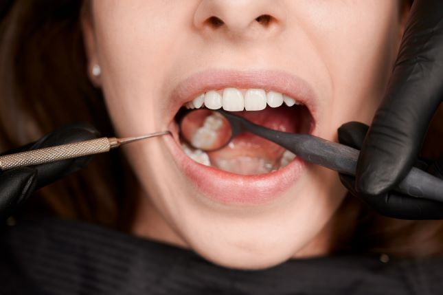 teeth extractions near you