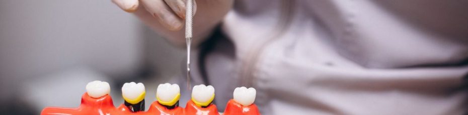 dental bridges and crowns near you